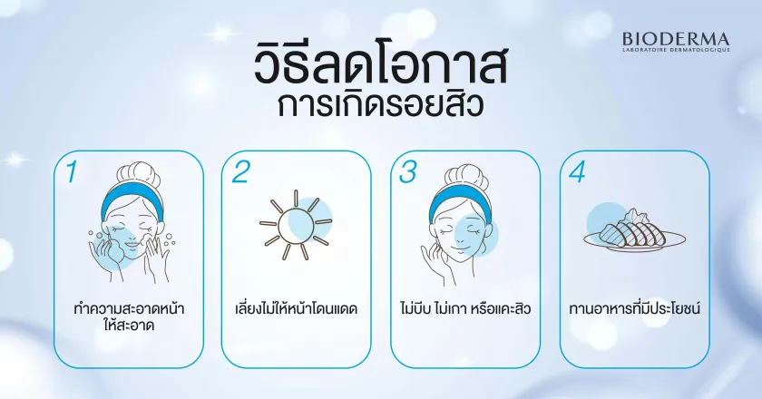 วิธีลดโอกาสการเกิดรอยสิว ทำได้อย่างไร