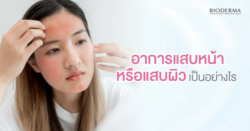 อาการแสบหน้าหรือแสบผิวเป็นอย่างไร