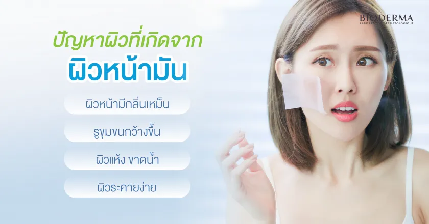 ปัญหาผิวที่เกิดจากผิวหน้ามัน