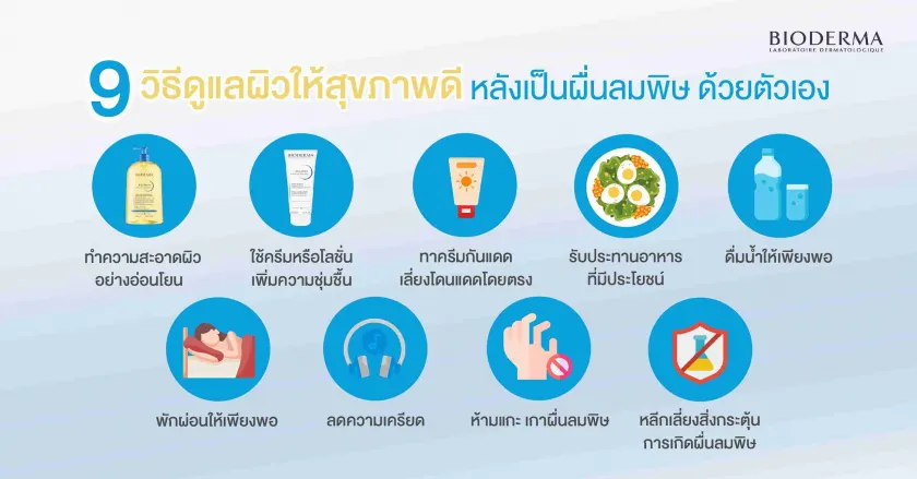 9 วิธีดูแลผิวให้สุขภาพดีหลังเป็นผื่นลมพิษ ด้วยตัวเอง