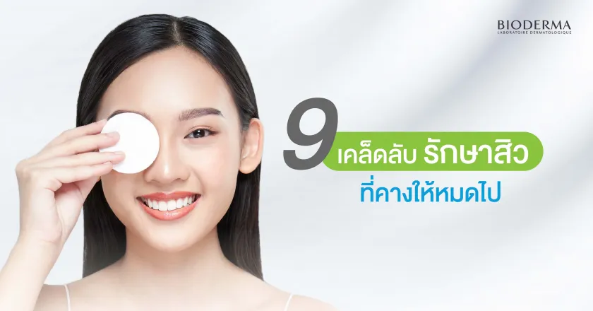 8 เคล็ดลับ รักษาสิวที่คางให้หมดไป