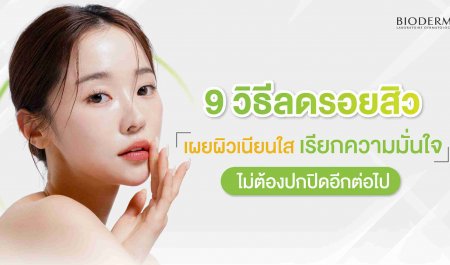 9 วิธีลดรอยสิว เผยผิวเนียนใส เรียกความมั่นใจ ไม่ต้องปกปิดอีกต่อไป