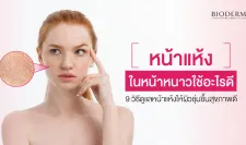 หน้าแห้งในหน้าหนาวใช้อะไรดี? 9 วิธีดูแลหน้าแห้ง ให้ผิวชุ่มชื้นสุขภาพดี