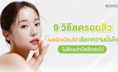 9 วิธีลดรอยสิว เผยผิวเนียนใส เรียกความมั่นใจ ไม่ต้องปกปิดอีกต่อไป