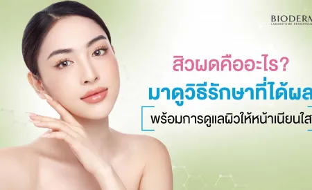 สิวผดคืออะไร? มาดูวิธีรักษาที่ได้ผล พร้อมการดูแลผิวให้หน้าเนียนใส