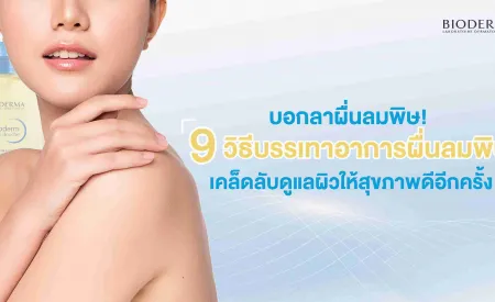 บอกลาผื่นลมพิษ! 9 วิธีบรรเทาอาการผื่นลมพิษ เคล็ดลับดูแลผิวให้สุขภาพดีอีกครั้ง